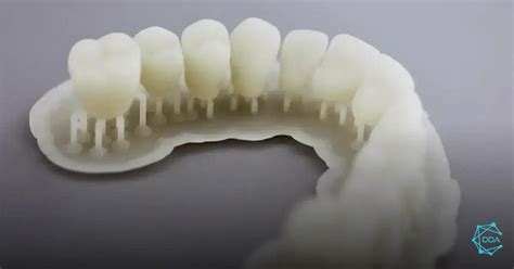 Guia Prático Como Iniciar a Jornada de Impressão 3D na Odontologia