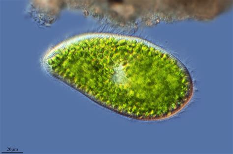 Paramecium Bursaria Acc Common Pond Water Sample Organisms Inaturalist