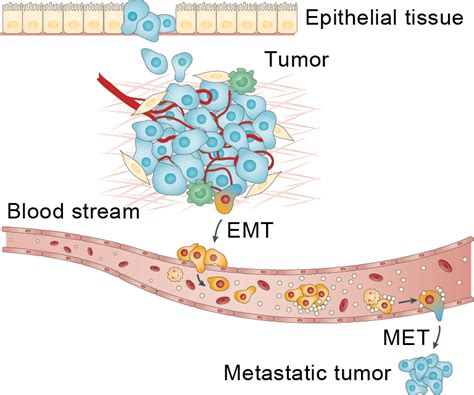 Epithelial Mesenchymal Transition Cancer