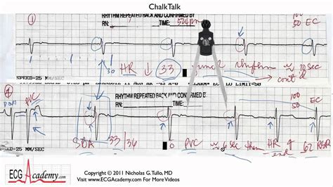 14 Read Ecgs Like An Expert Basic Ekg Interpretation Youtube