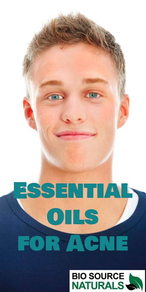 8 Best Essential Oils For Acne Diy Acne Spot Treatment Teenage Acne