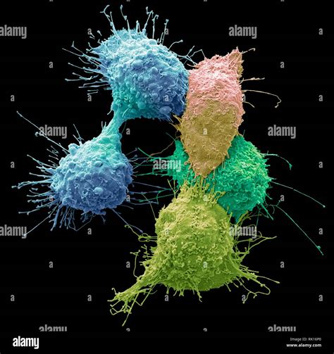 Ovarian Cancer Cells Sem Stock Photo Alamy