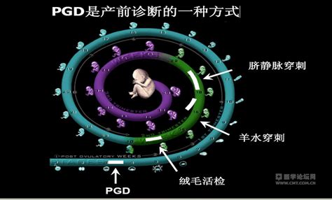 首例单基因遗传病胚胎植入前遗传学诊断成功病例