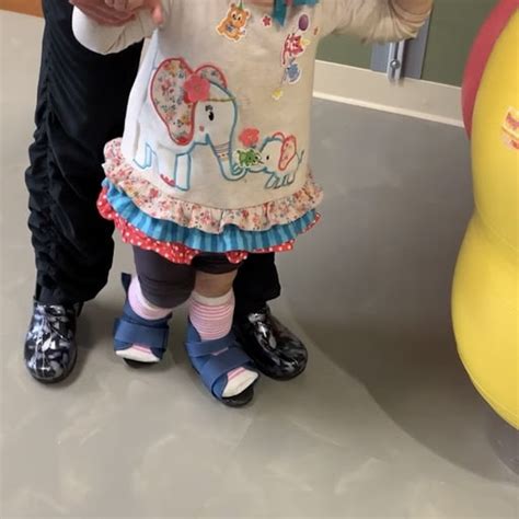 Learn About Pediatric Serial Casting Milestone Therapy
