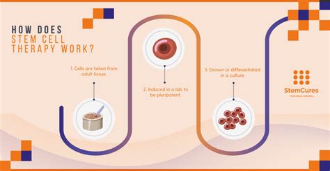 Differences Between Prolotherapy Stem Cell Therapy And PRP StemCures