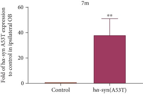 High H Syn Expression In The Ipsilateral Olfactory Bulb A