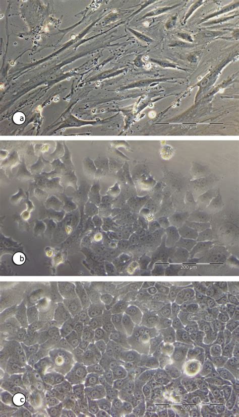 Phase Contrast Micrographs Of Human Lung Endothelial Cells And