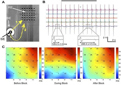 Guidance Of Conduction Path Using High Frequency Suprathreshold AC