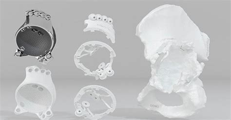 Webinar Engineering At Point Of Care With 3d Printing