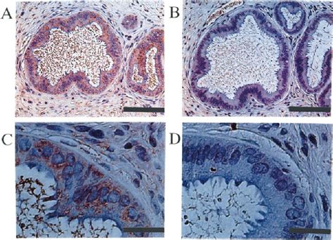 Immunohistochemical Staining Of Secretory Leukocyte Protease Inhibitor