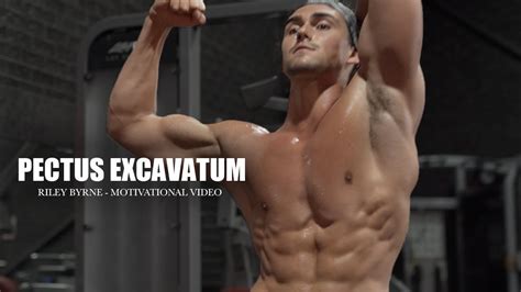 PECTUS EXCAVATUM BODYBUILDING YouTube