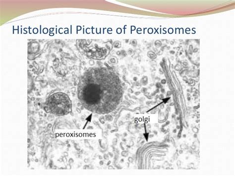 Peroxisome Is Present In - Nehan Opal