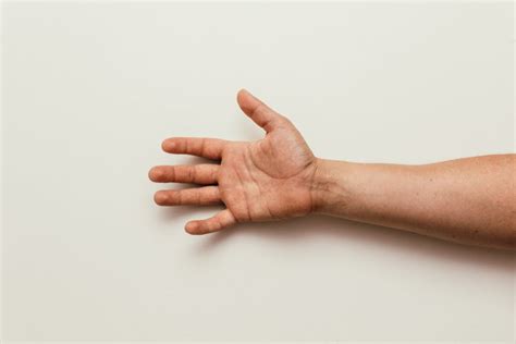 Why Does My Hand Hurt? 10 Possible Causes and Treatments