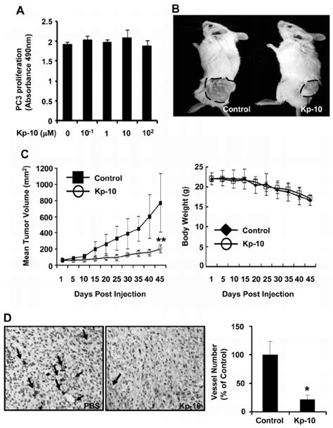 Kp Inhibits Tumor Growth And Tumor Angiogenesis In Xenograft Mice