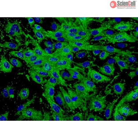 Human Dermal Microvascular Endothelial Cells HDMEC