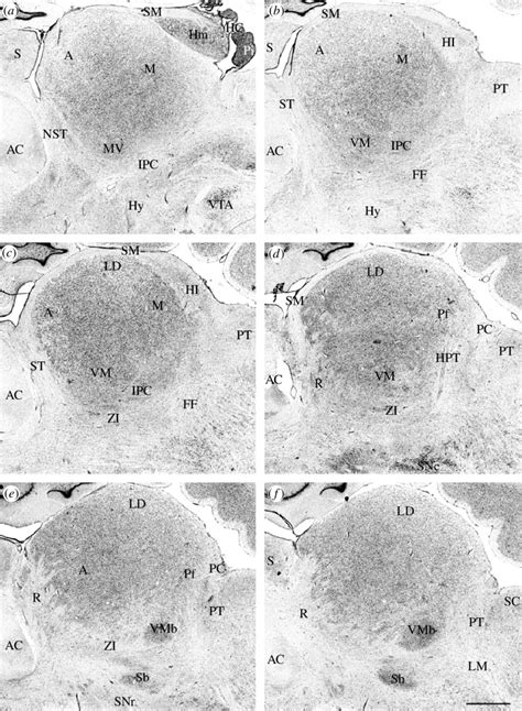 A L Nissl Stained Parasagittal Sections In A Medial To L