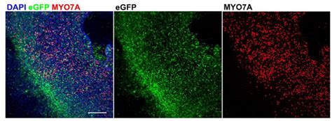 Biomolecules Free Full Text Efficient Viral Transduction In Fetal