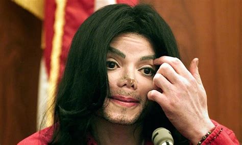 Michael Jackson Calvo Y Con Cicatrices En Todo El Cuerpo Revelan