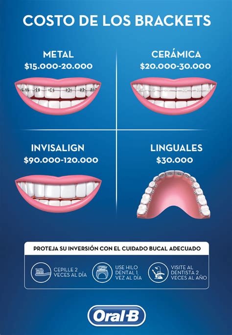 Cu Nto Cuesta Ponerse Brackets Met Licos Precios Y Tipos De Brackets