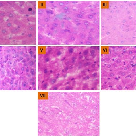 Histopathology Of Liver Tissues Under 40x Microscope I Normal Download Scientific Diagram