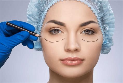 Saiba Tudo Sobre A Blefaroplastia Blefaroplastia Niterói