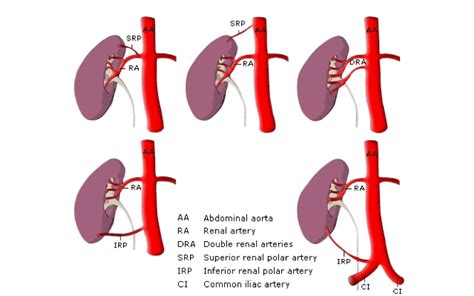 Kidney Structures Learn Surgery Online