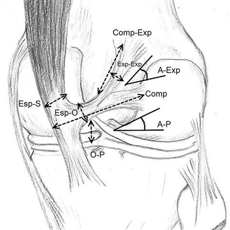 (PDF) Oblique popliteal ligament - an anatomical study