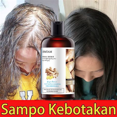 Jual 100 Asli Shampo Penumbuh Rambut Cepat Serum Rambut Rontok Botak