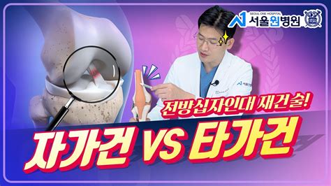 전방십자인대 재건술 자가건 Vs 타가건 무엇이 좋은가요 Youtube