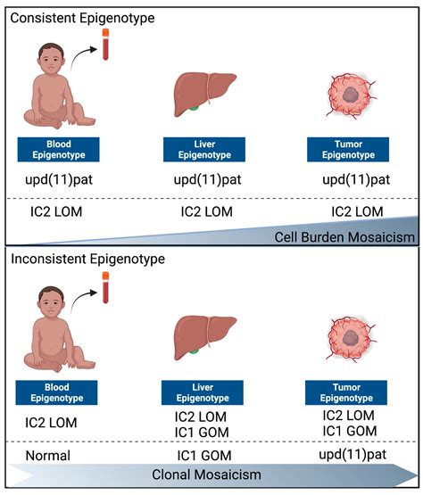 Cancers Free Full Text Occurrence Of Hepatoblastomas In Patients