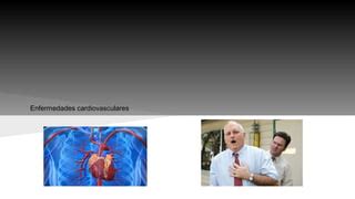 Cmc Enfermedades Cardiovasculares Ppt