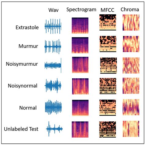 Sensors Free Full Text Feature Based Fusion Using Cnn For Lung And