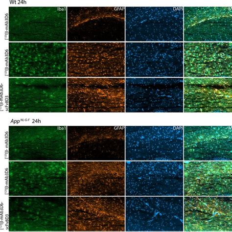 Iba1 And GFAP Staining Of The Intact Hippocampus Contralateral To The