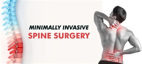 Minimally Invasive Spine Surgery Amritsar Amandeep Hospital