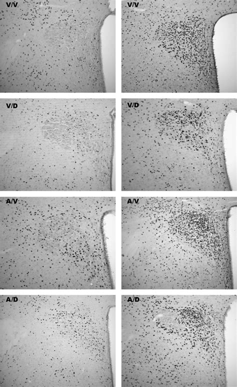 Representative Photomicrographs Of Fos Immunoreactivity In The Mpdpvn