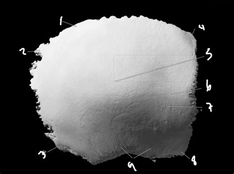 Diagram of parietal bone features part 1 | Quizlet