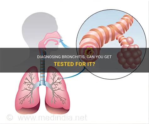 Diagnosing Bronchitis: Can You Get Tested For It? | MedShun