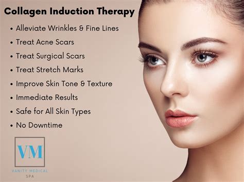 Microneedling Collagen Induction Therapy Vanity Medical Spa