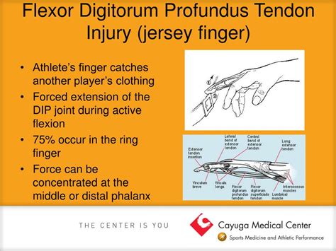 Ppt Common Hand And Wrist Injuries Powerpoint Presentation Free Download Id3950482