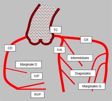 Pr Cis Danesth Sie Cardiaque Cath T Risme Cardiaque Et