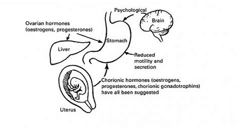 Hyperemesis gravidarum Treatment, Risk Factors, Causes, Diet, Symptoms and Signs - Jotscroll