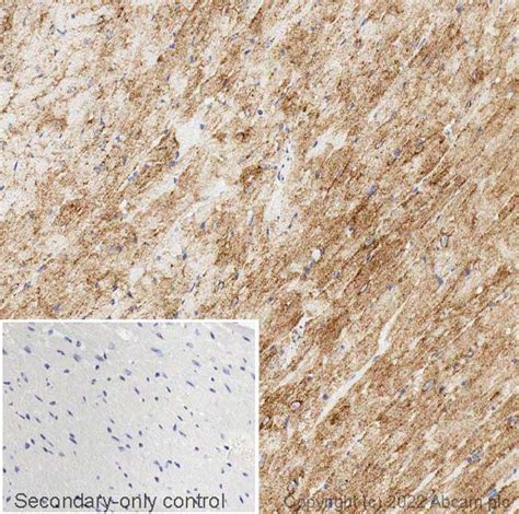 Anti Glucose Transporter Glut4 Antibody Ab33780 Abcam