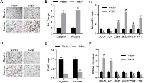 The Methylation Of Htert Promotes Sclc Migration And Invasion A