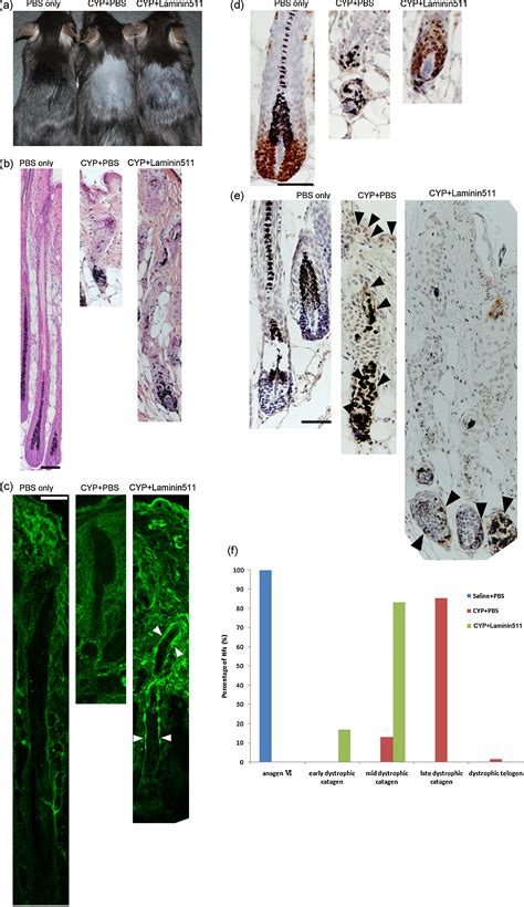 Laminin Inducer Of Hair Growth Is Down Regulated And Its