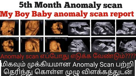 Anomaly Scan Weeks In Tamil Th Month Anomaly Scan Report In