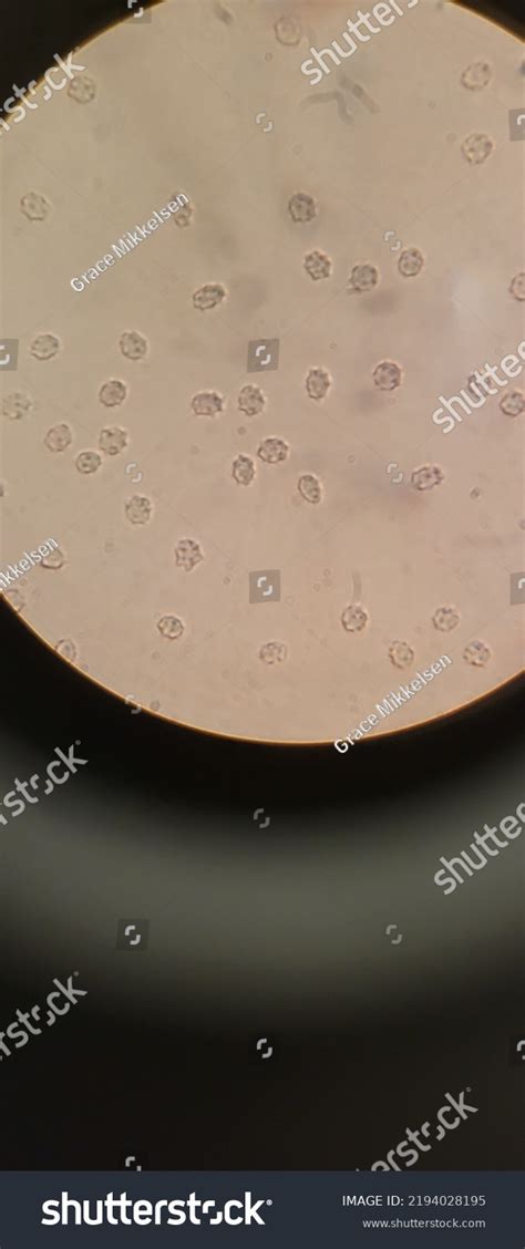 Red Blood Cells Bacteria Under Microscope Stock Photo 2194028195 ...