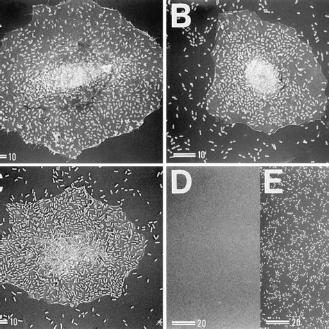 Scanning Electron Micrographs Showing Adherence To HeLa Cells And