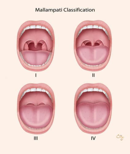 Lab Quiz Basic Airway Management Flashcards Quizlet