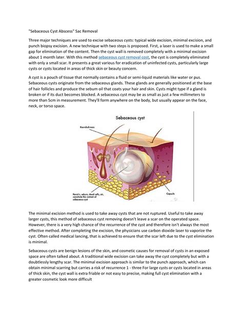 Sebaceous cyst abscess by dsimeonov - Issuu