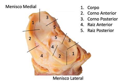 Lesões Meniscais E Fisio